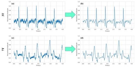 Self-Attention MHDNet: A Novel Deep Learning Model for the Detection of ...