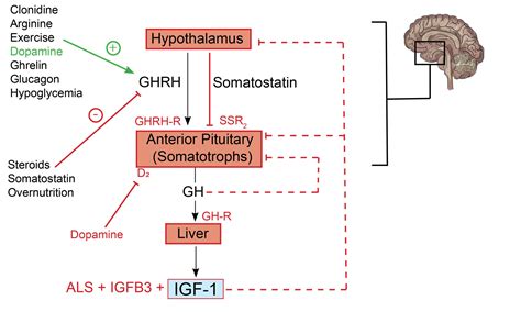 Acromegaly Diagram