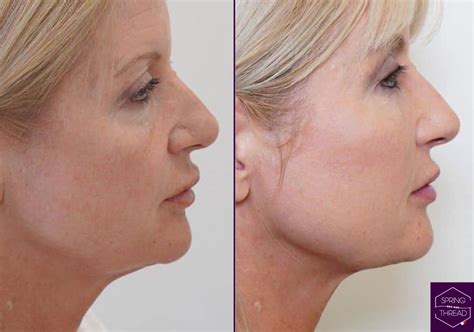 Spring Thread 的图像结果