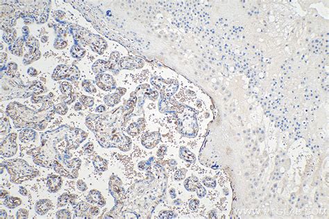 Adiponectin antibody (66239-1-Ig) | Proteintech