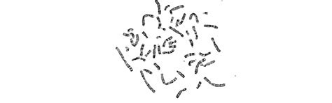 Home - INDIAN ACADEMY OF MEDICAL GENETICS(IAMG)