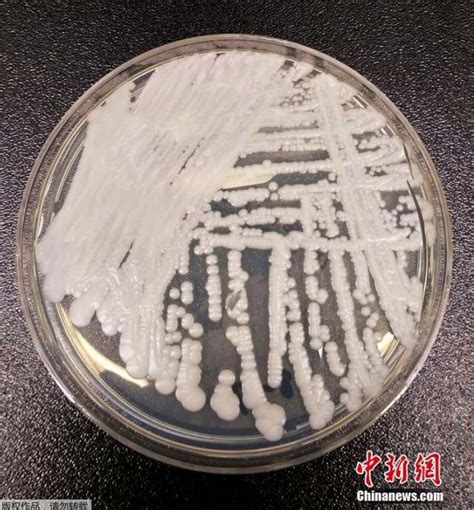 “超级真菌”很可怕？北京市疾控中心回应 - 智汇 - 新湖南