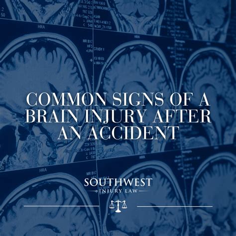 Common Signs of a Brain Injury After an Accident - Southwest Injury Law