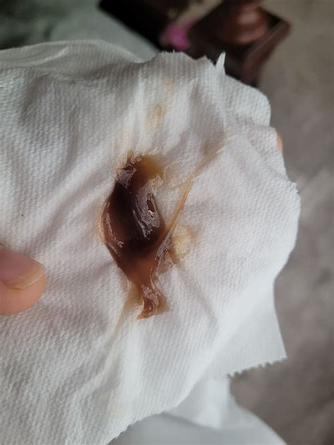 Light Brown Mucus Discharge What Do Vaginal Discharge Colors Mean?