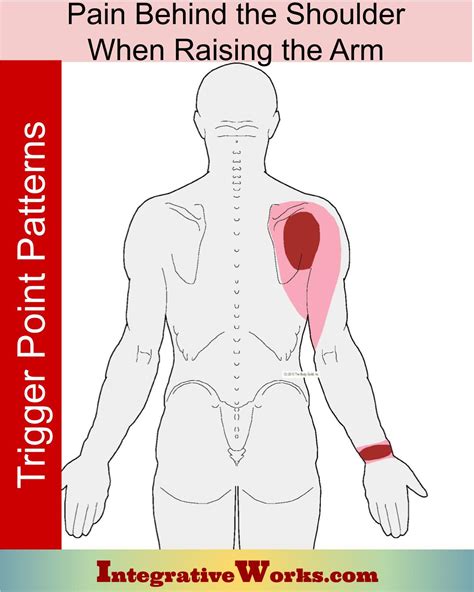 Pain Behind the Shoulder When Lifting Arm - Integrative Works