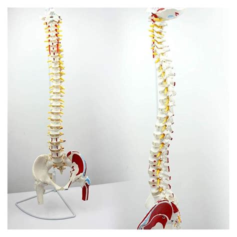 Buy Study Model Anatomical Spine Model Spine With Muscle Coloring ...