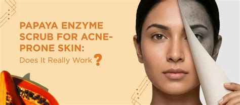 Best Dark Spot Removal Creams in India (2025) | Dermatologist Guide ...