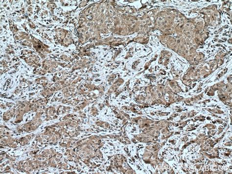 SOCS3 antibody (66797-1-Ig) | Proteintech