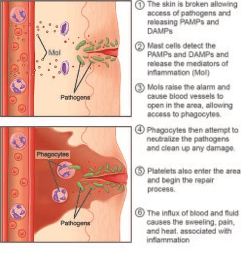 Inflammation Process Steps 的图像结果