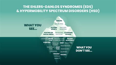 The iceberg model of Ehlers Danlos Syndromes EDS and Hypermobility spectrum disorder HDS concept ...