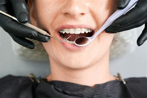 Tooth Extraction 的图像结果