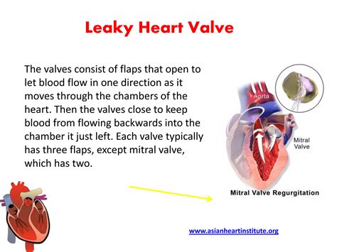 What Is A Leak In The Heart