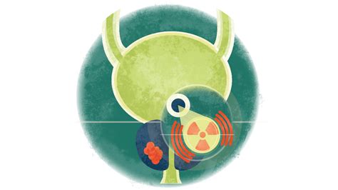 Prostate Radiation Simulation 的图像结果