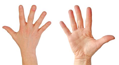 Image result for High-Resolution Hand MRI