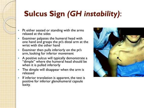 Image result for Sulcus Sign Shoulder