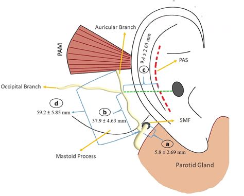 Posterior Auricular Nerve Bells Palsy Recovered From Face Paralysis 2
