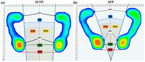 Self-Selected Comfortable Foot Position in Upright Standing ...