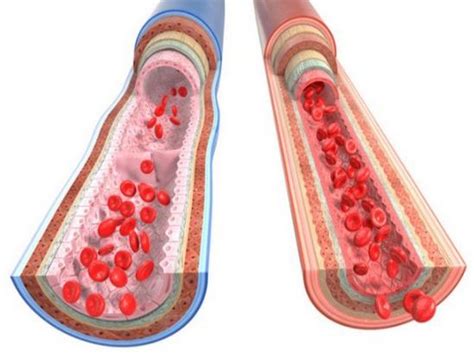 Study finds ageing stiffens blood vessels in women