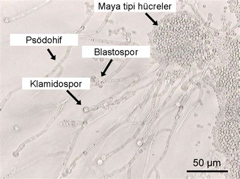 Bildergebnis für candida paragusa