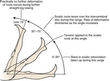 SLR Testing 的图像结果