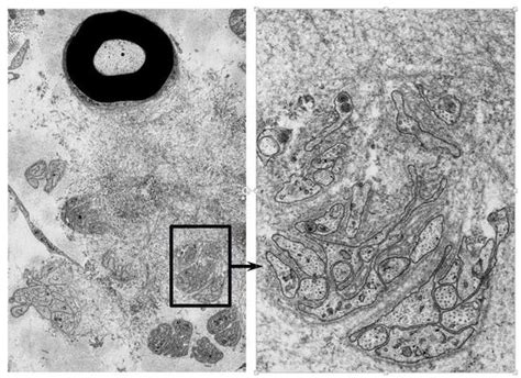 Biomedicines | Special Issue : Recent Advances in Amyloid Research ...