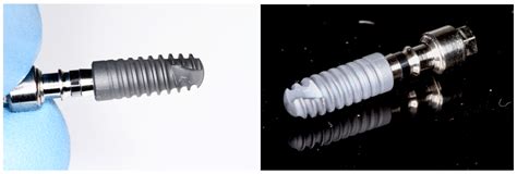 Zirconia Dental Implant Designs and Surface Modifications: A Narrative ...