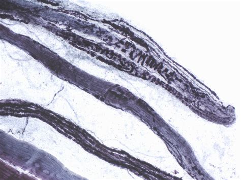 Image result for Muscle Spindle