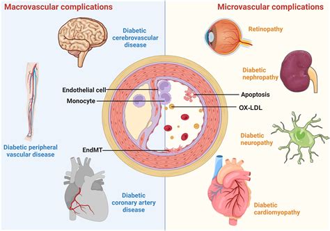 Frontiers | Endothelial dysfunction in vascular complications of diabetes: a comprehensive ...