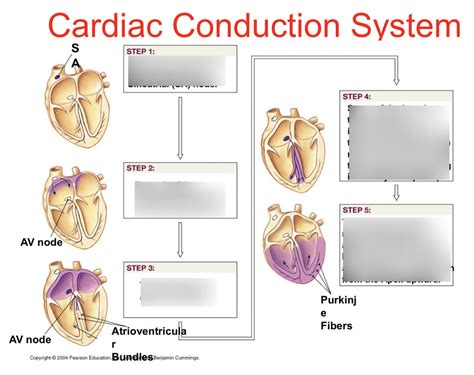 Image result for Cardiac Conduction System Disorders