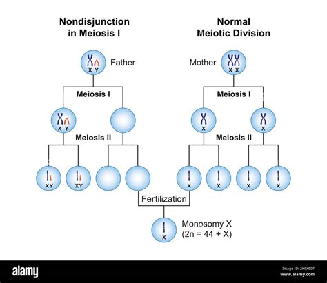 Scientific Designing of Nondisjunction in Monosomy X (Turner Syndrome) . Colorful Symbols ...