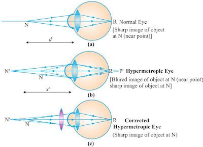 Image result for Science Class 10 Human Eye Notes
