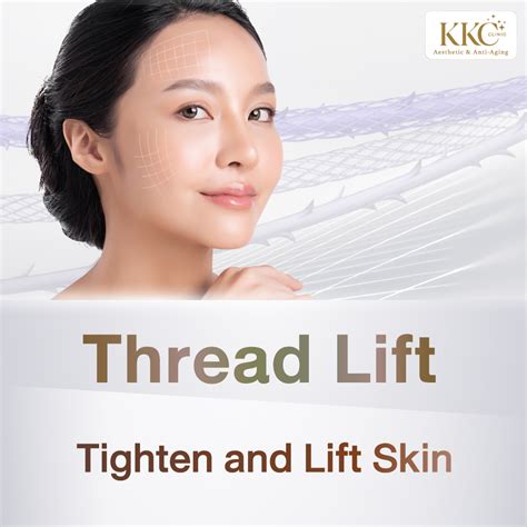 Image result for Thread Lift