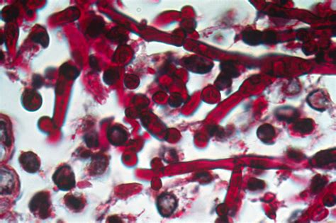 Kuvatulokset haulle candida