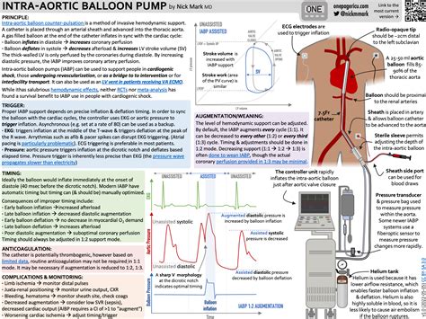 Intra-aortic balloon pumps (IABP) — ICU One Pager