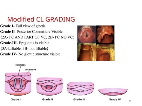 Airway Assessment1.pptxghhhghjkkkkfhhhjjjj | PPTX