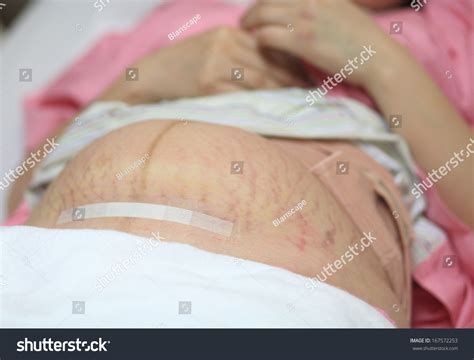 8,942 Cut On Stomach Images, Stock Photos & Vectors | Shutterstock