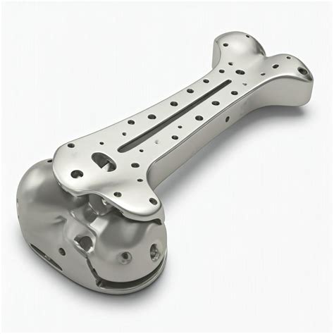 Custom Bone Plates via Titanium 3D Printing - MET3DP