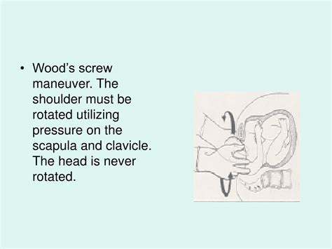 PPT - Dystocia caused by fetal anomalies PowerPoint Presentation, free ...