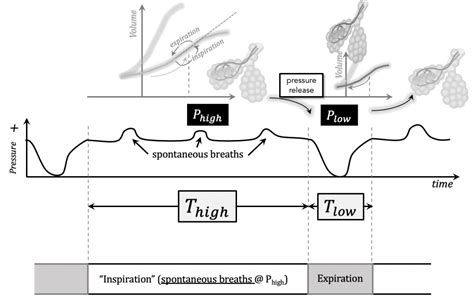 Aprv Pressure Time Graph 的图像结果