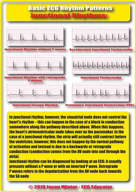 Image result for Telemetry Practice