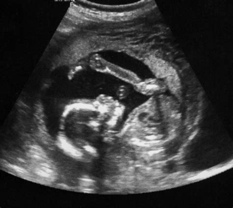 Maternal Fetal Medicine - Petals Imaging - Petals Health