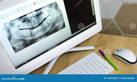 Image result for Teeth Computer