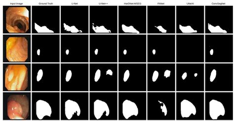 Image result for Colonoscopy Image System Component