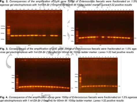 Image result for Enterococcus Faecalis Hemolytic Activity