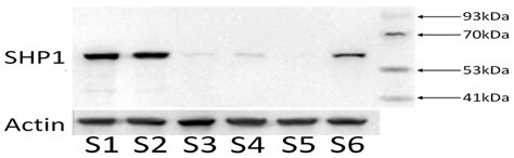 Effects of PTPN6 Gene Knockdown in SKM-1 Cells on Apoptosis, Erythroid ...