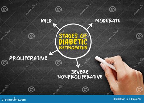 Stages Of Diabetic Retinopathy (diabetes Complication That Affects Eyes ...