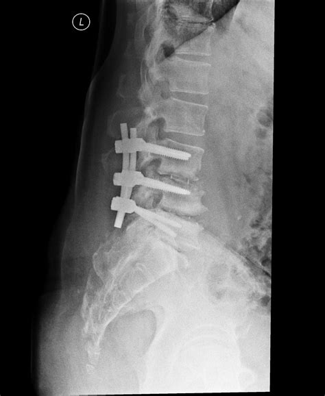 Book SURGICAL / NON SURGICAL MANAGEMENT OF SPINE Services by Dr Manish ...