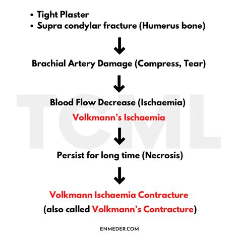 Causes Of Volkmann's Ischemic Contracture