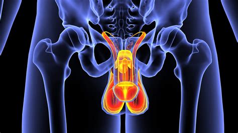 Penile Cancer Pictures