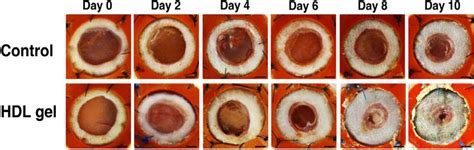The Impact of Lipoproteins on Wound Healing: Topical HDL Therapy ...